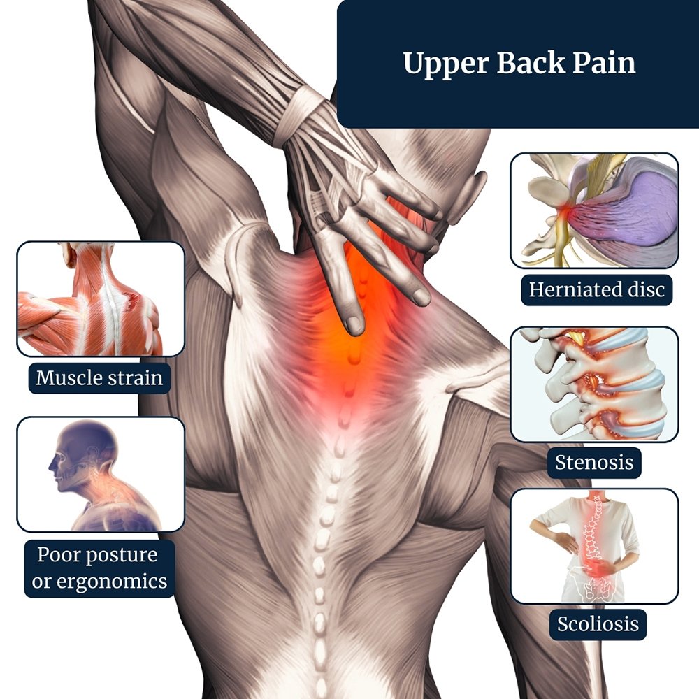 17 Hidden & Clinical Causes of Mid Back Pain in Brookfield Residents – Expert Insights from Physiokraft