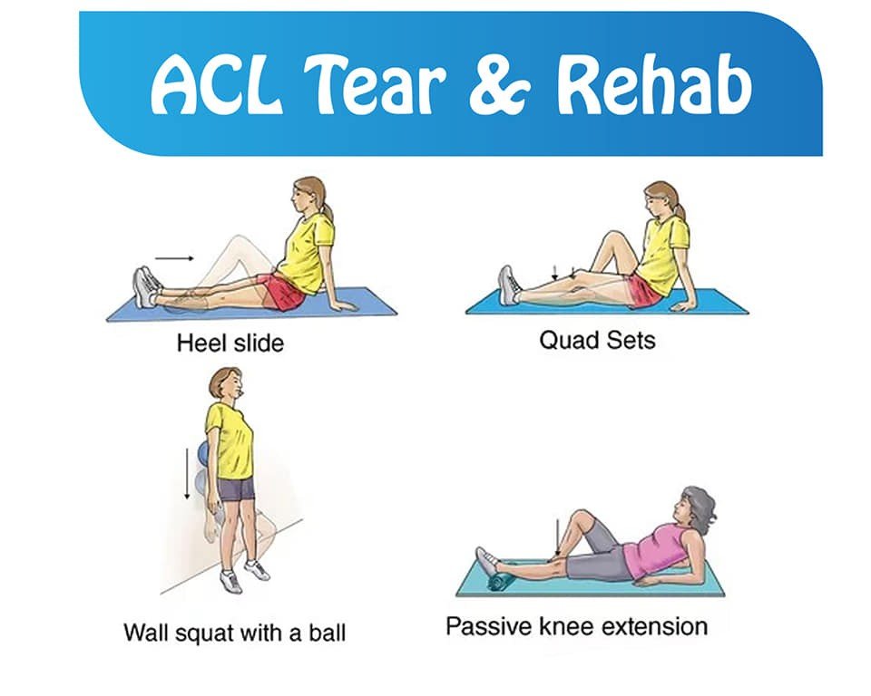 ACL tear rehabilitation in Brookfield