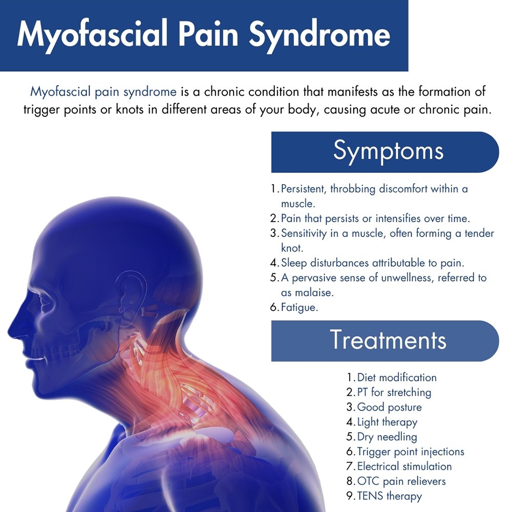 Myofascial trigger point treatment in whitefield