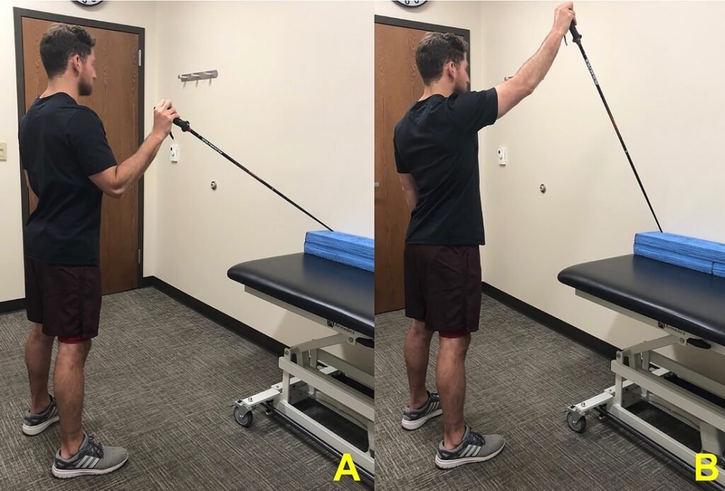 Shoulder dislocation rehabilitation in AECS Layout